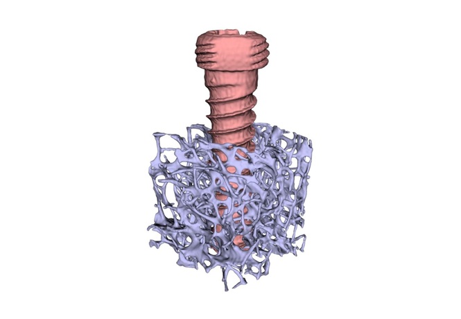 Image: Bone structure reveals optimal position for screws in fractures (Photo courtesy of A. Reisinger/KL Krems)